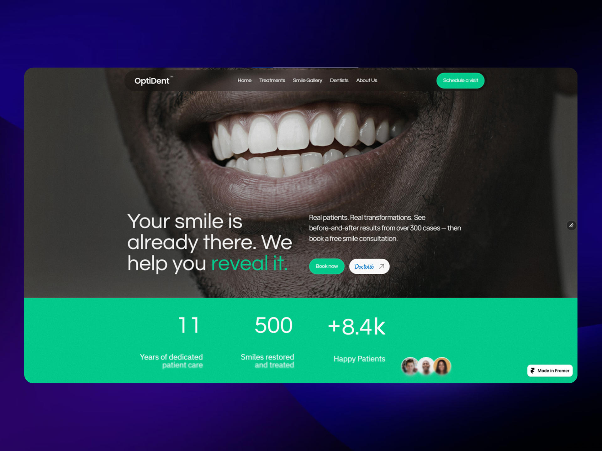 Screenshot 2 of OptiDent